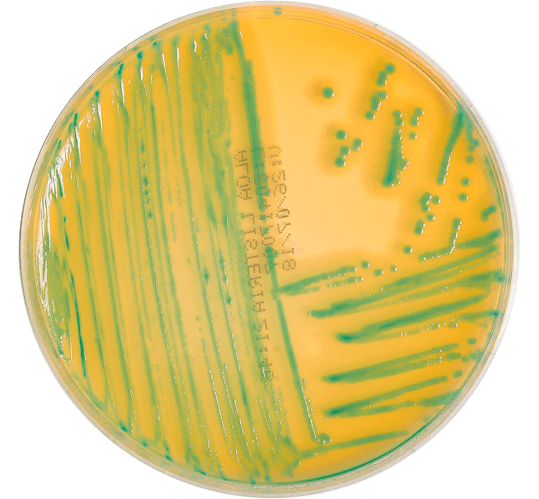 Listeria ALOA ágar 1 540118