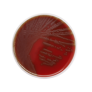 Agar-Sangue