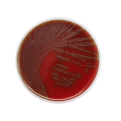Sangue ágar 1 Agar-Sangue