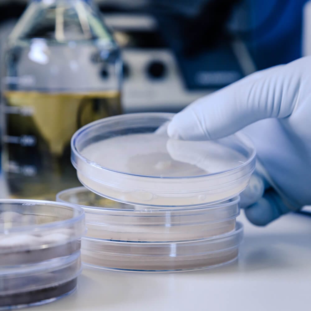 Solabia Diagnósticos Brasil 6 solabia-cropped-hand-scientist-holding-petri-dishes-table-1