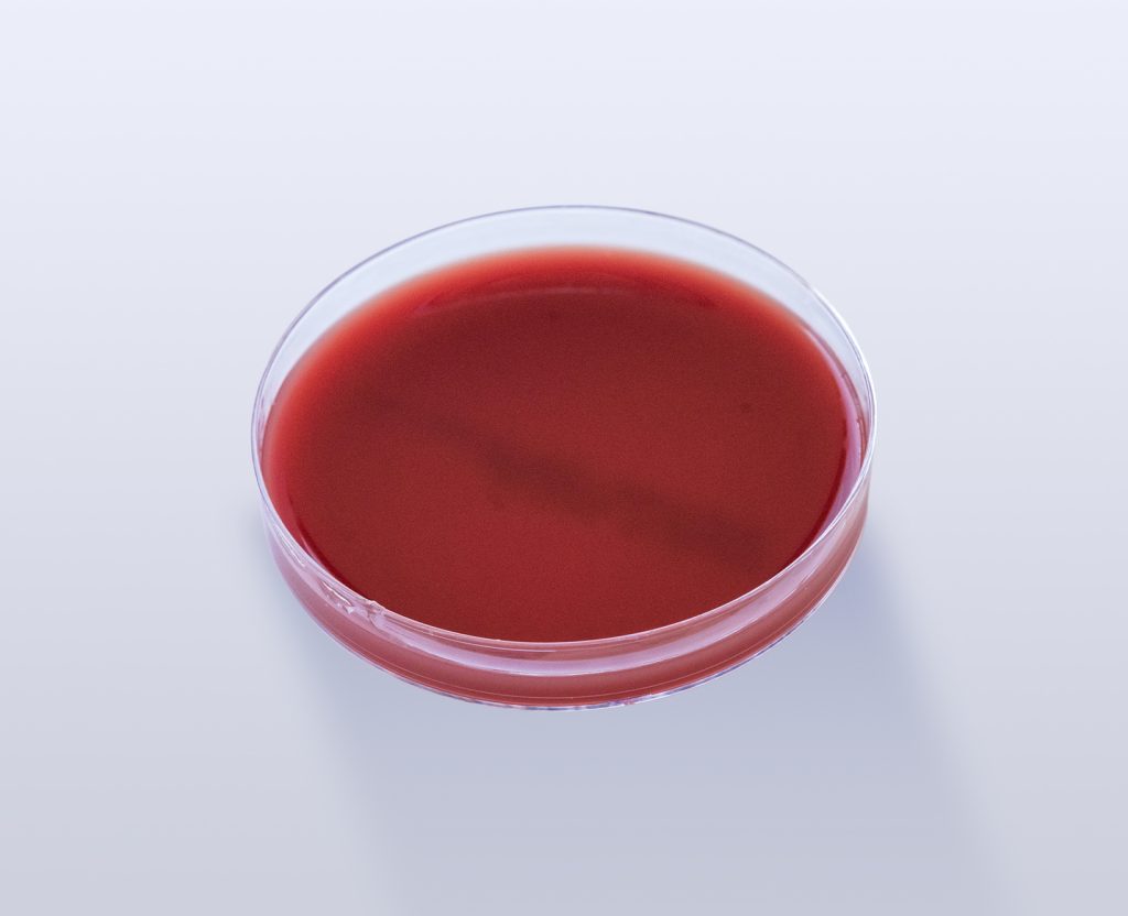 Gonorreia: cultura, isolamento e identificação 5 Agar Sangue de Cavalo