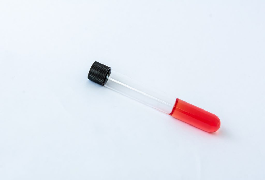 Meios de identificação bioquímica 1
