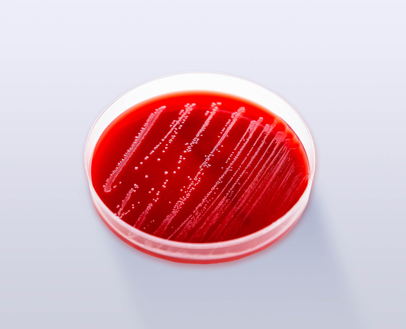 Ágar sangue de carneiro 5% base TSA 1 NBF_9901_PL1135_site
