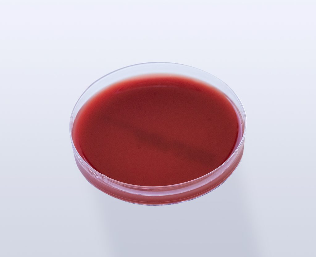 Anaeróbios: Características e Mudanças do BrCast/Eucast 2023 5 PLACA AGAR MUELLER HINTON COM SANGUE DE CARNEIRO NBF 1595 site