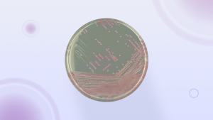 card_serie_Meios-Cromogenicos_blog_CHROMagar-MRSA