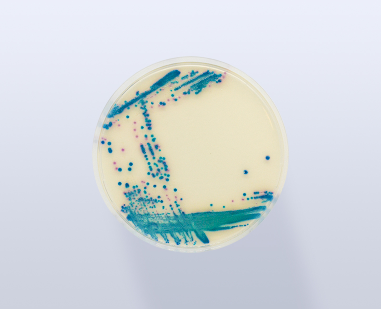 CHROMagar ESBL - placa 90mm 1 imagem-site-ESBL