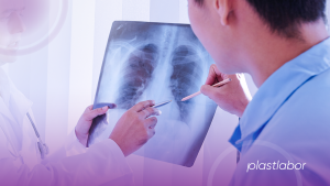 pneumonia_misteriosa_blog